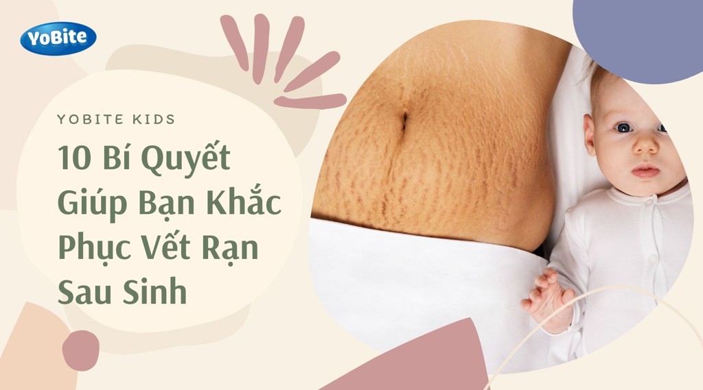 10 BÍ QUYẾT GIÚP BẠN KHẮC PHỤC VẾT RẠN SAU SINH