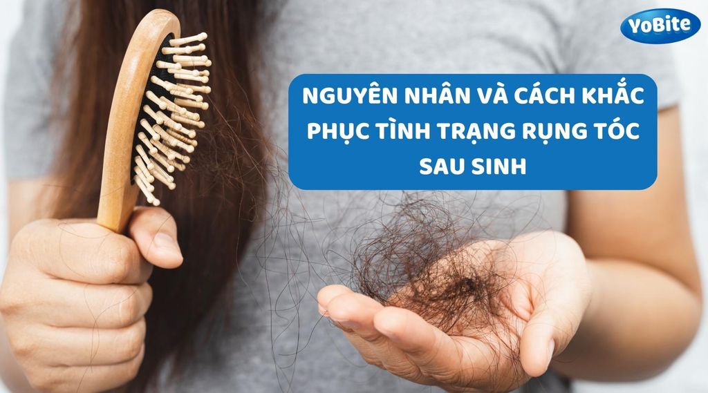 NGUYÊN NHÂN VÀ CÁCH KHẮC PHỤC TÌNH TRẠNG RỤNG TÓC SAU SINH Ở PHỤ NỮ